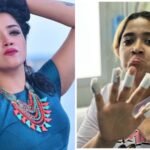 Accident while doing cooking video!  Abhirami Suresh opened up about what happened