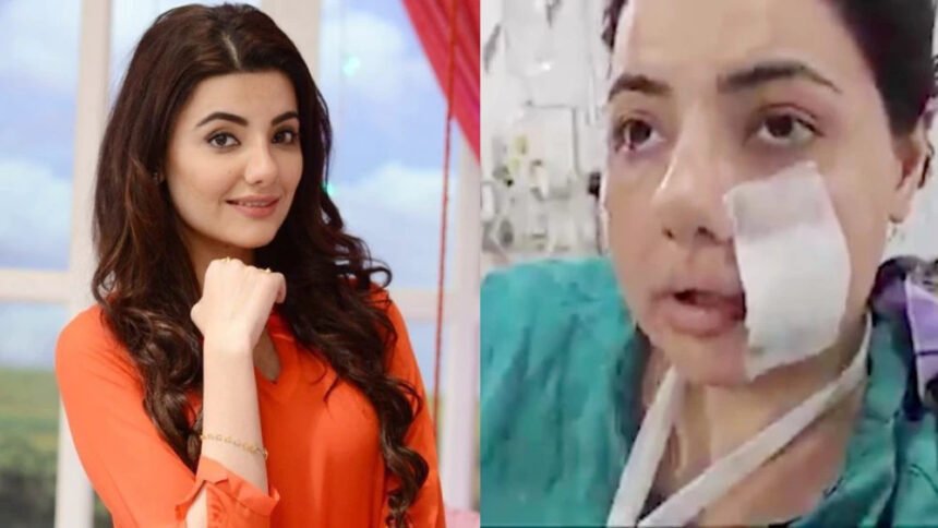 Have you seen the current status of Pakistani actress?  This brutality was done to the actress by the quotation team, the quotation was given by her ex-husband, because of this