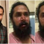 Mob attack on actor Chetan Chandra, the actor's nose was broken, he was returning from a temple visit with his mother, this is the reason for the attack