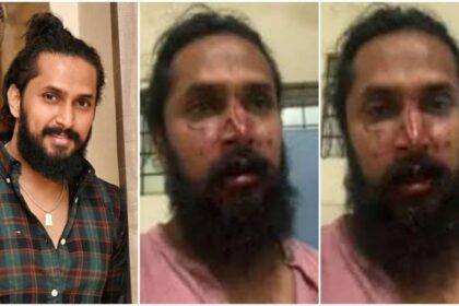 Mob attack on actor Chetan Chandra, the actor's nose was broken, he was returning from a temple visit with his mother, this is the reason for the attack
