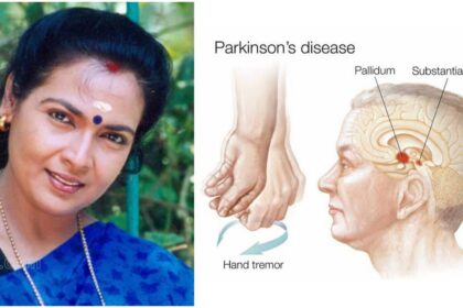There is no cure for this disease – What caused the death of actress Kanakalatha with Parkinson's disease?  Read in detail