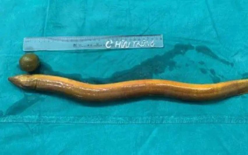 What was taken out was an eel 25 inches long and four inches wide. The live fish was inserted through the anus;  Limbs were bitten off