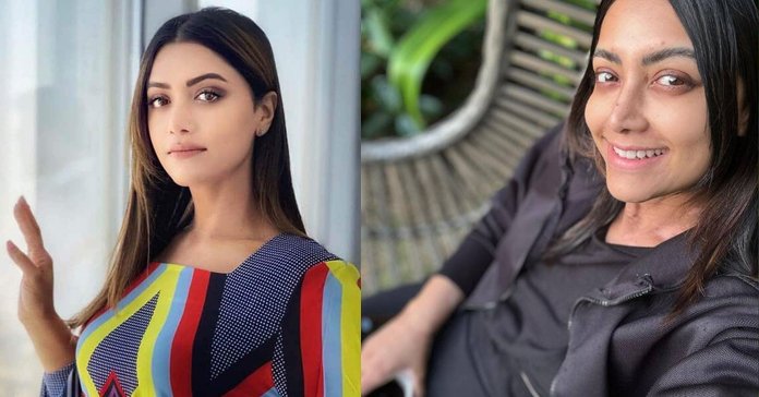 If I have cursed God, if I have fallen on my knees, it is for Mamta. Scars on hands disappear.